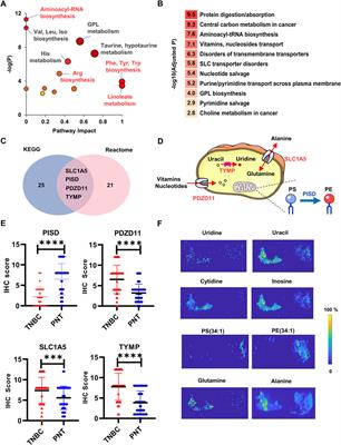 Screening and diagnosis of triple negative breast cancer based on rapid metabolic fingerprinting by conductive polymer spray ionization mass spectrometry and machine learning